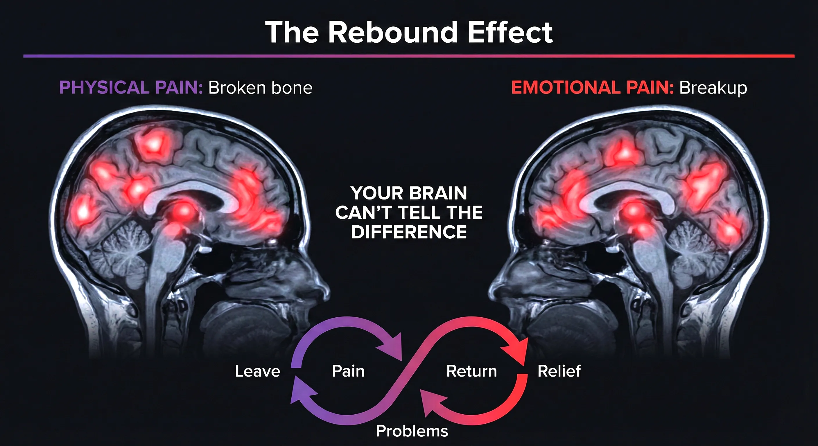 Why leaving an anxious-avoidant relationship feels impossible